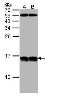 Anti-NHP2-like protein 1 Antibody