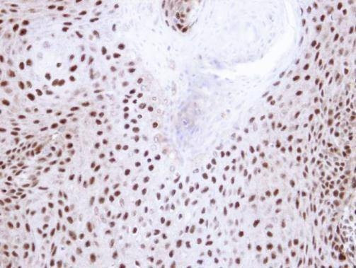 Anti-NHP2-like protein 1 Antibody