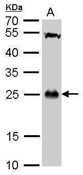Anti-GSTT1 Antibody