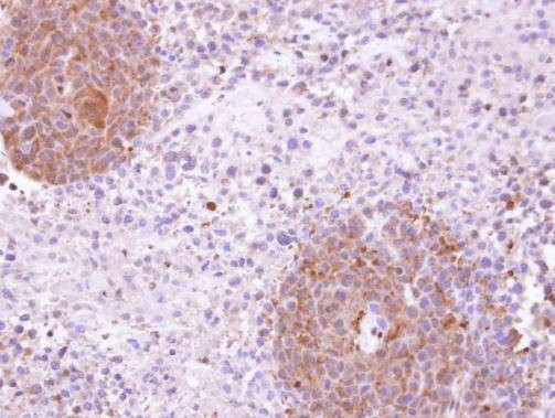 Anti-KHS (internal) Antibody
