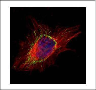 Anti-AP1S2 Antibody