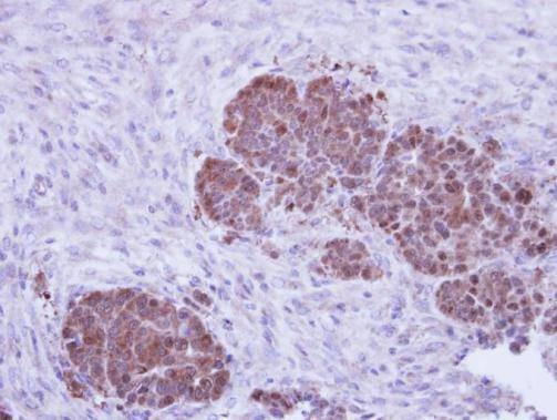 Anti-ZNF259 Antibody