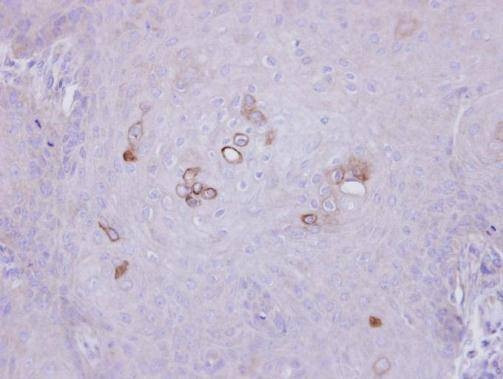 Anti-PHKA1 (C-term) Antibody