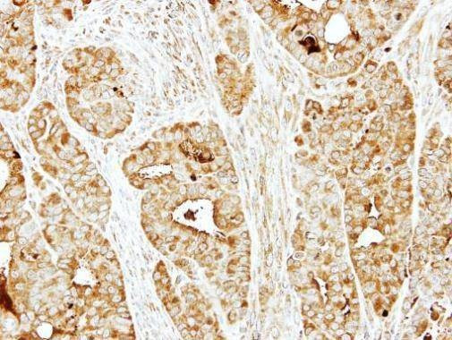 Anti-BBS10 (internal) Antibody