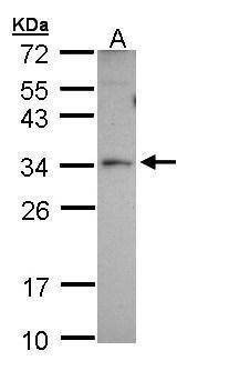 Anti-PEX26 Antibody