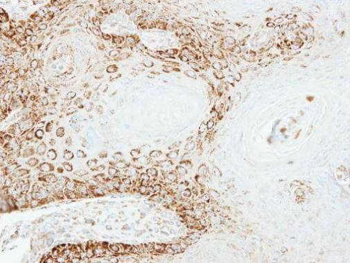 Anti-PEX26 Antibody