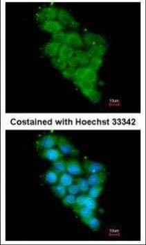 Anti-NDUFA12 Antibody