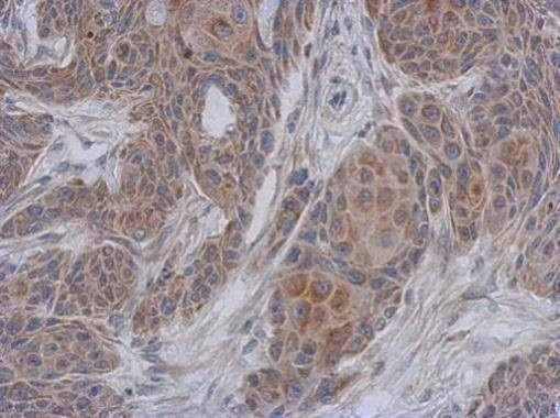 Anti-NDUFA12 Antibody