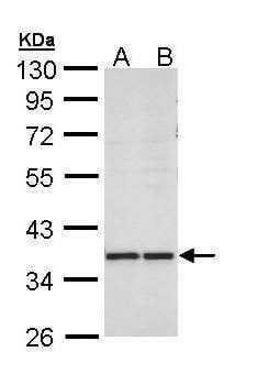 Anti-AKR1B10 Antibody