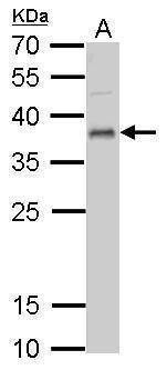 Anti-UFD1L Antibody