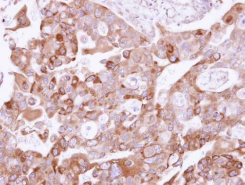 Anti-UFD1L Antibody