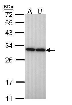 Anti-PGAM2 Antibody