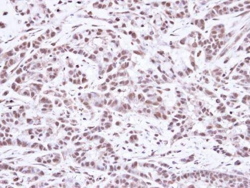Anti-SMC1A (N-term) Antibody