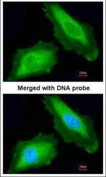 Anti-DDX3 Antibody