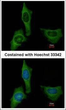 Anti-Factor X Antibody