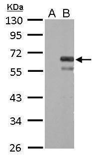 Anti-Factor X Antibody