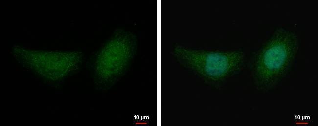 Anti-Fumarate hydratase Antibody