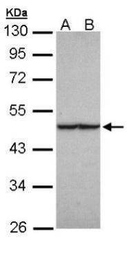 Anti-Fumarate hydratase Antibody
