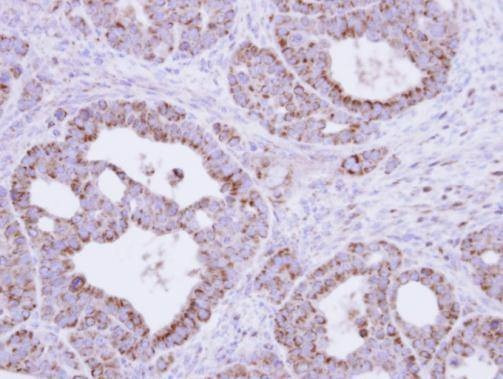 Anti-Fumarate hydratase Antibody
