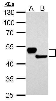 Anti-Cytokeratin 13 Antibody