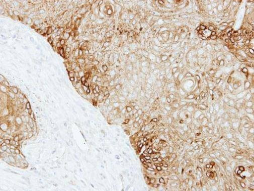 Anti-Cytokeratin 13 Antibody