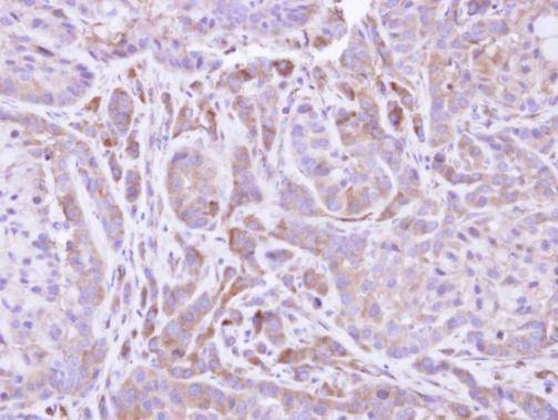 Anti-FMO2 Antibody
