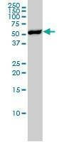 Anti-YES1 Antibody