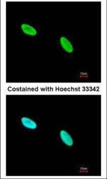 Anti-Ku80 (internal) Antibody