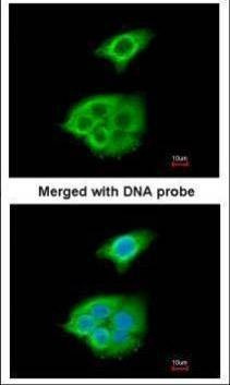Anti-Pancreatic Lipase Antibody