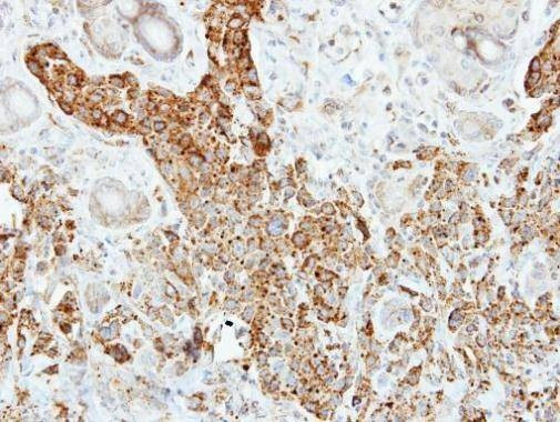 Anti-Pancreatic Lipase Antibody