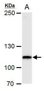 Anti-O-GlcNAc transferase Antibody