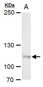 Anti-O-GlcNAc transferase Antibody