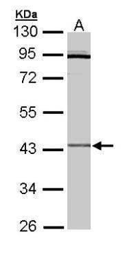Anti-CRLF1 Antibody