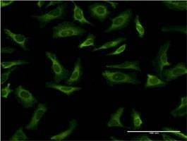 Anti-YWHAG Antibody