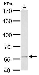 Anti-MCD (internal) Antibody