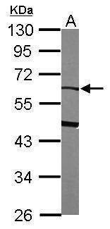 Anti-alpha 2 Antiplasmin Antibody