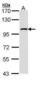 Anti-LARS2 (internal) Antibody