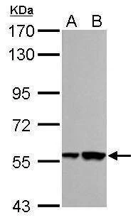 Anti-RBMY1A1 Antibody