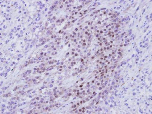Anti-RBMY1A1 Antibody
