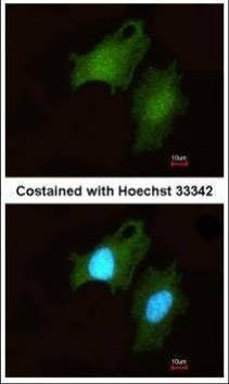 Anti-DIP2B (C-term) Antibody