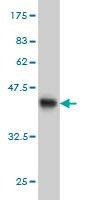 Anti-YWHAH Antibody