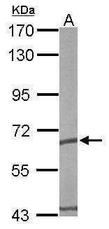 Anti-TCP1 epsilon Antibody