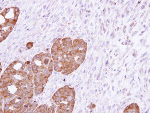 Anti-TCP1 epsilon Antibody
