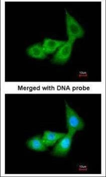 Anti-Cortisol Binding Globulin Antibody