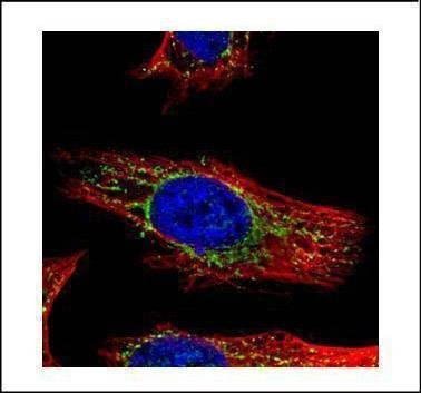 Anti-GALNS Antibody