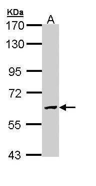 Anti-GALNS Antibody