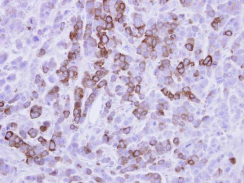 Anti-MX1 (internal) Antibody