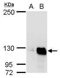 Anti-Glycine dehydrogenase (internal) Antibody
