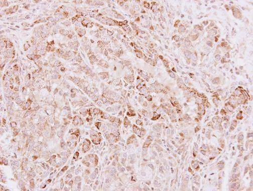 Anti-Glycine dehydrogenase (internal) Antibody