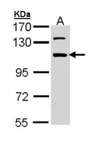 Anti-RBM28 Antibody